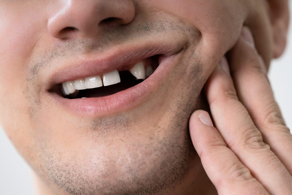 The Long Term Impact of Missing Teeth on Facial Structure and Health