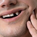 The Long Term Impact of Missing Teeth on Facial Structure and Health