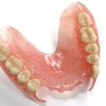 Best Tooth Replacement Solutions for Missing Teeth and Stability