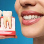 What Are Dental Implants and How Missing Tooth Replacement in Adajan Restores Your Smile