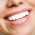 How Teeth Whitening Can Instantly Brighten Your Smile and Confidence