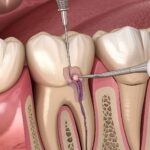 Understanding Your Smile: A Relatable Perspective on Dental Care in Hubli