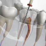 Preserving Your Smile: A Modern Look at Dental Care in Solapur