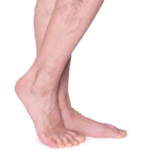 Lotus Laser Skin Rejuvenation – The Best Laser Hair Removal Clinic in Sherwood Park