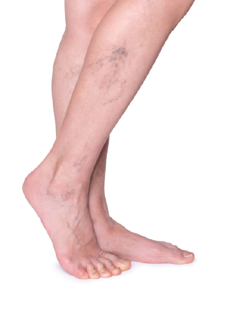 Lotus Laser Skin Rejuvenation – The Best Laser Hair Removal Clinic in Sherwood Park