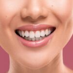 How Modern Smile Makeovers Are Redefining Confidence and Facial Aesthetics