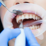 Why Professional Teeth Cleaning Is Essential for a Healthier, Brighter Smile