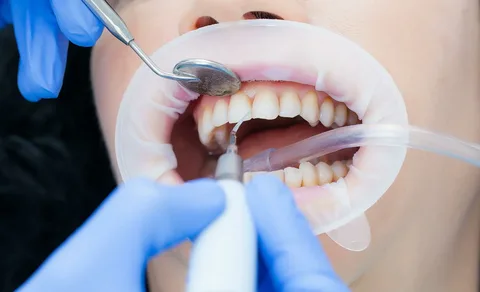 Why Professional Teeth Cleaning Is Essential for a Healthier, Brighter Smile