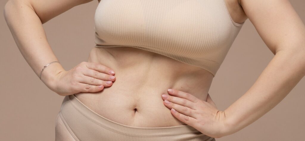 Best Doctors in Dubai Known for Precision Liposuction Results