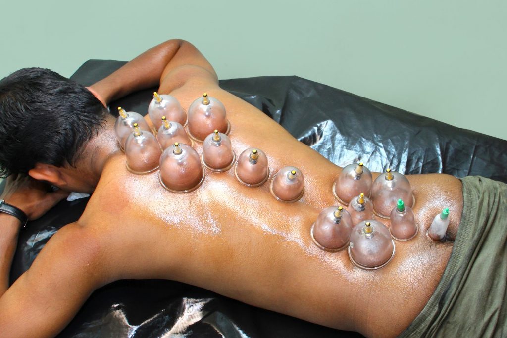 Hijama Treatment Cost and Session Length Explained