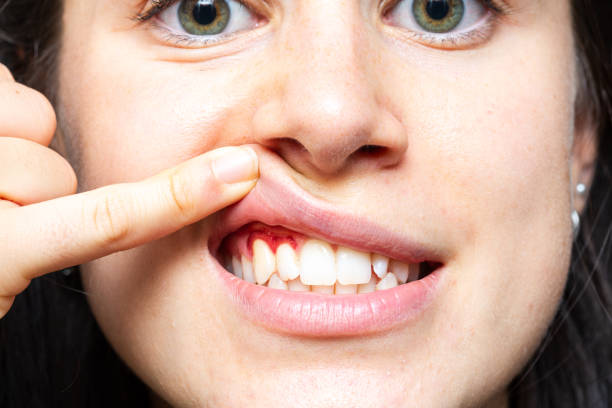 Why Do Your Gums Bleed? Understanding the Root Causes and Solutions