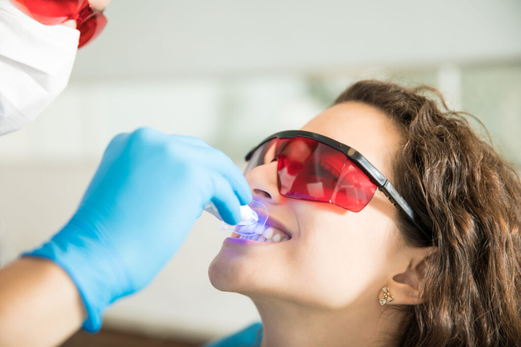 Why Teeth Whitening Is Best Done at the Dentist in Hubli