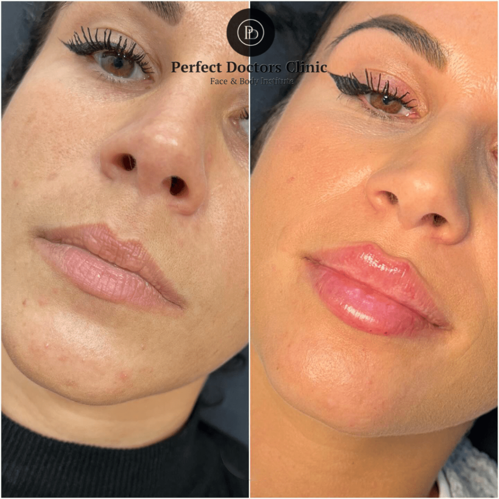 Juvederm Technology Used by the Best Aesthetic Clinics in Dubai
