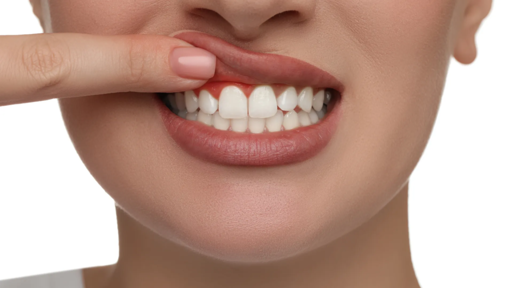 Understanding the Importance of Best Dental Gum Care Badlapur for Your Health
