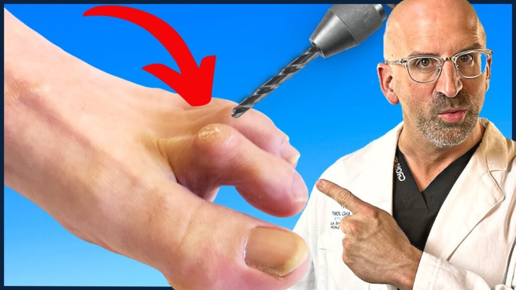 Hammertoe Pain Treatment by a Podiatrist in Edinburgh