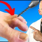 Hammertoe Pain Treatment by a Podiatrist in Edinburgh