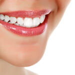 Unlocking Dental Radiance with Teeth Whitening in Bhandara
