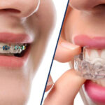 Capital Dental Dental Clinic in Madinaguda | Best Dental Hospital in Madinaguda – Dr. Yamini Mannava