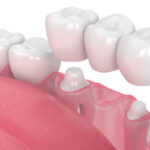 Vih Dental Clinic in Kukatpally | Best Dental Hospital in Kukatpally | Dentist in Kukatpally – Dr. Meenakshi Mudnoor