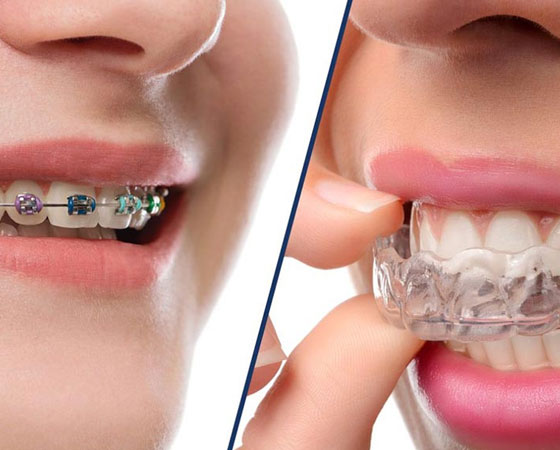 Serene Dental Clinic in Kondapur | Best Dental Hospital in Kondapur | Dentist in Kondapur – Dr. Vineeth Reddy