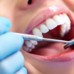 Understanding Your Smile and Professional Teeth Cleaning Cost in Parel Mumbai