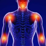 Importance of Rheumatology in Managing Autoimmune Diseases