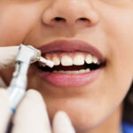 The Importance Of Regular Teeth Cleaning For Oral Health