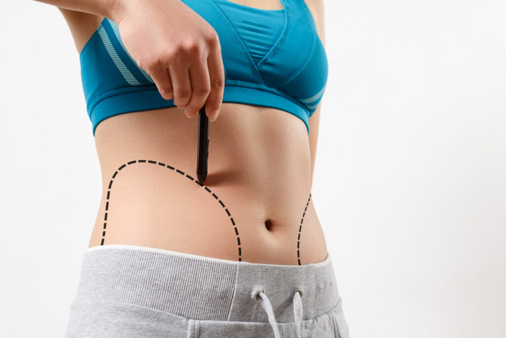 The Science Behind Liposuction by the Best Doctors in Dubai