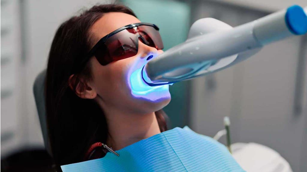 How to Choose the Right Dental Clinic for Teeth Whitening?