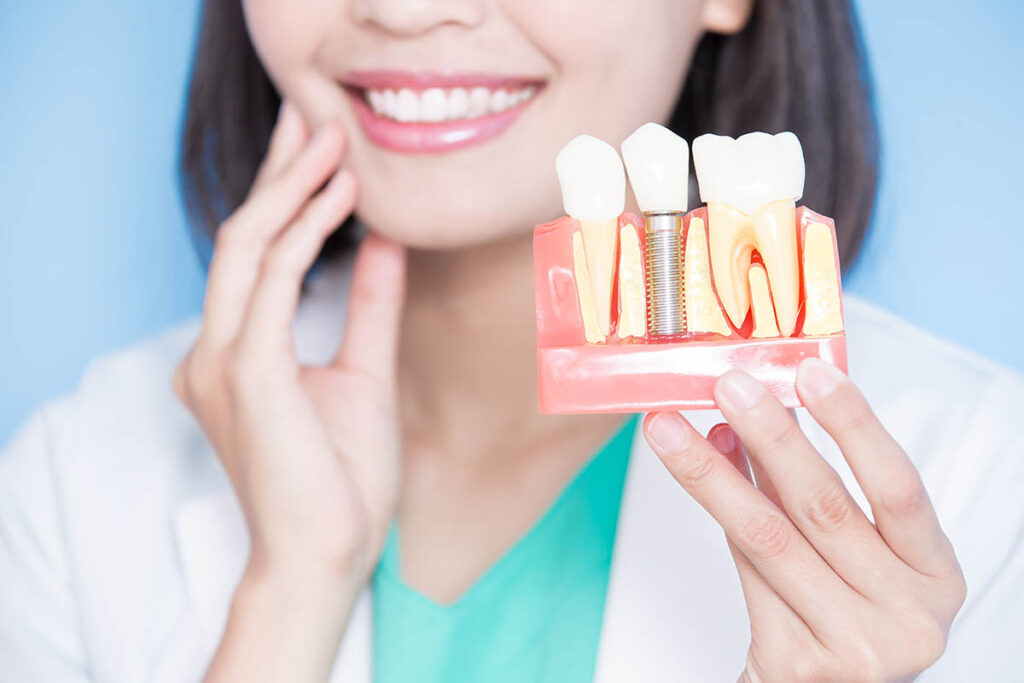 Dental Implants in Marathahalli: Types, Procedure, Cost & Benefits