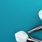 A New Chapter for Your Smile with Dental Implants