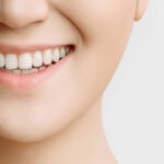 How Professional Teeth Whitening Boosts Smile Confidence