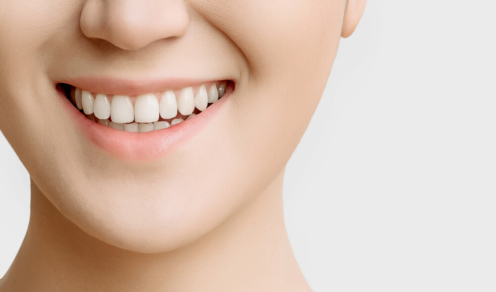 How Professional Teeth Whitening Boosts Smile Confidence