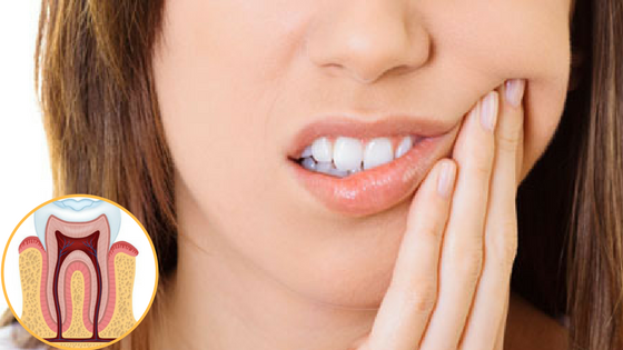 Painless Root Canal Treatment: Myth or Reality?