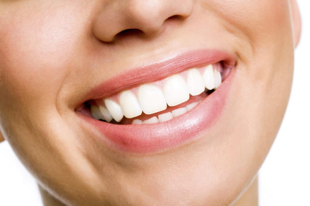 Seasonal Teeth Whitening: When Is the Best Time?