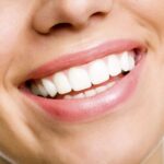 Seasonal Teeth Whitening: When Is the Best Time?