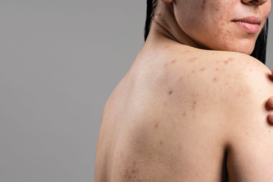 What Are the Top 10 Skin Diseases? Causes, Symptoms, and Treatment Options
