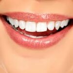 How Diet Changes Support Teeth Whitening Results