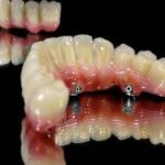 How to Choose Reliable Local Dental Lab Services for Clinics Nearby