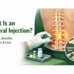 What Is an Epidural Injection? Procedure, Benefits, Side Effects & Cost