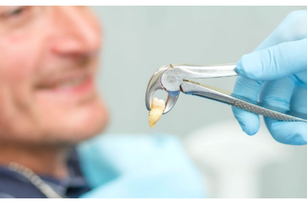 Tooth Extraction: What To Expect Before And After