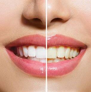 Looking for a Friendly Smile in Bromley? Discover Dental Care Right on Your Doorstep