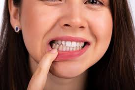 Benefits of Timely Gum Treatment: Protecting Your Oral and Overall Health