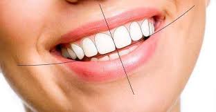 How Digital Smile Designing Transforms Your Smile with Precision