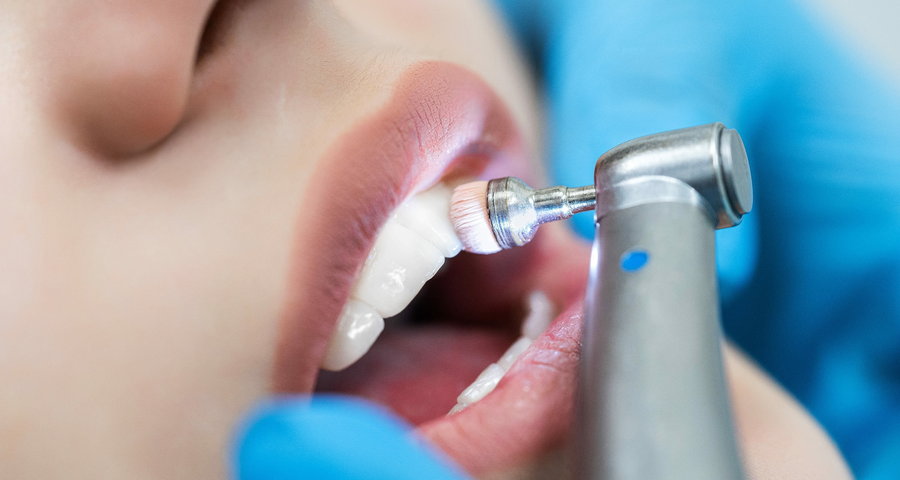 What Is the Teeth Cleaning Cost in Navi Mumbai? A Complete Price Guide