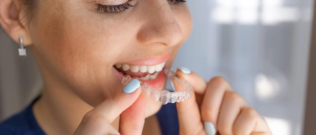 Everything You Need to Know About Invisalign Treatment: Procedure, Benefits & Results