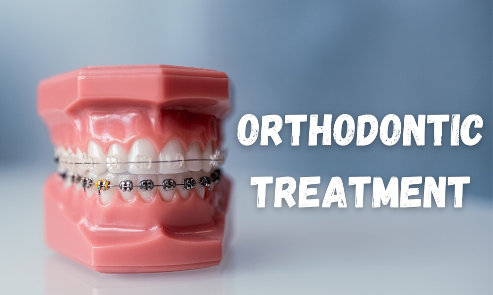 Orthodontic Treatment Benefits: More Than Just a Beautiful Smile