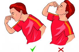 Simple Steps You Can Take to Treat a Nose Bleed Immediately