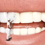 Why Choose a Walk-In Dental Clinic Scarborough Today?