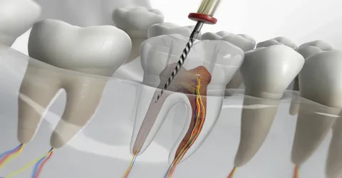 Laser Dentistry: Painless and Advanced Dental Care in Hinjewadi